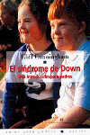 EL SNDROME DE DOWN